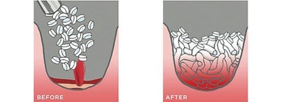 xstats-before-after